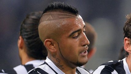 Arturo Vidal: Tengo la rodilla con mucho dolor y eso no me deja jugar bien