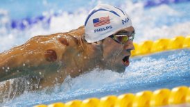 Círculos que lució Michael Phelps obedecen a terapia medicinal china