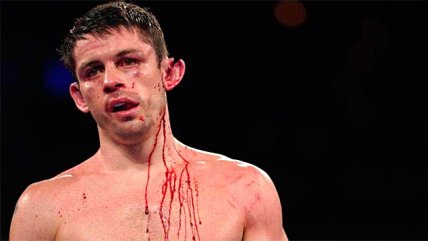 Boxeador casi pierde su oreja durante combate