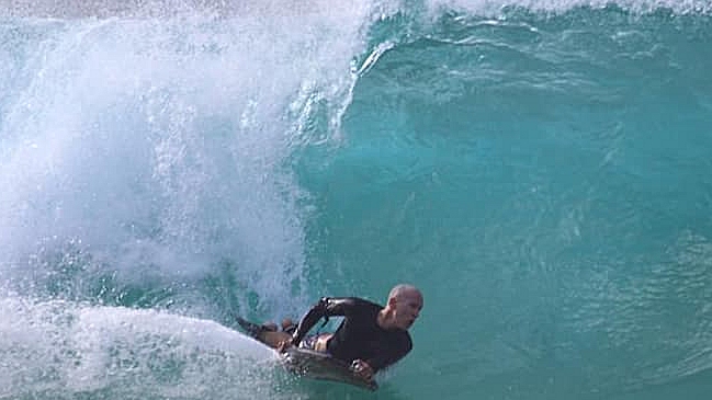 Surfista fue mordido en la cabeza por un tiburón en una playa de Brasil