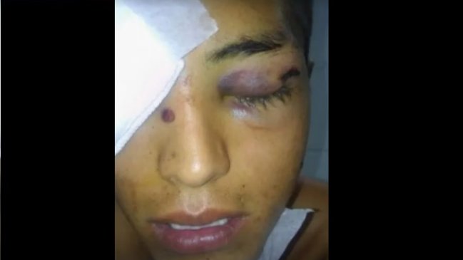 Policías fueron brutalmente agredidos por intentar detener partido de fútbol en zona con cuarentena