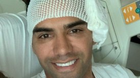 Radamel Falcao confirmó que está bien tras su fractura en el rostro