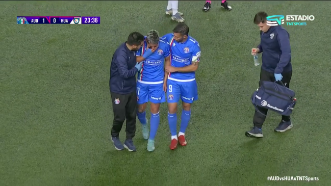 Luis Riveros dejó la cancha desconsolado tras recibir fuerte pelotazo en el Audax-Huachipato