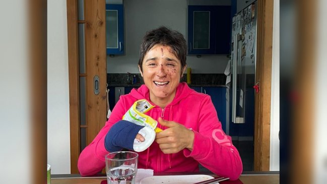 Bárbara Riveros dio cuenta de su duro proceso de recuperación tras grave accidente en Suiza