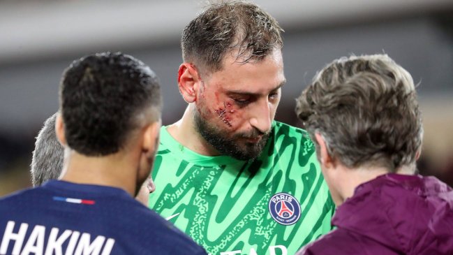 La BRUTAL patada que sacó a Gianluigi Donnarumma del duelo entre Mónaco y PSG